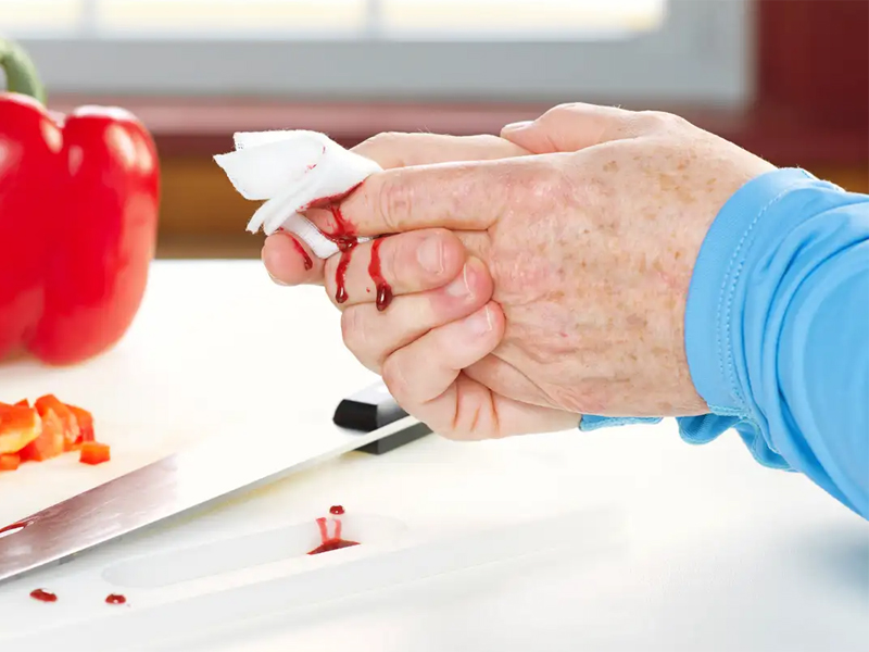 Обработка, лечение и восстановление кожи после порезов. Эплан для быстрого заживления порезов Препарат Эплан для лечения порезов